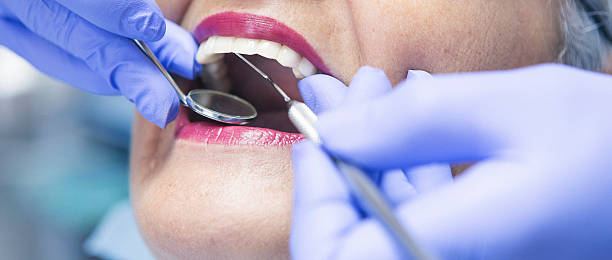 Best Emergency Treatment for Dental Infections or Abscesses in New Braunfels, TX